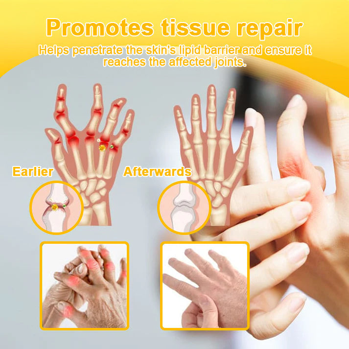 Nerve, Joint, or Arthritis Pain? This 15-Minute Cream Delivers Fast Relief & Deep Healing—No Pills, No Side Effects