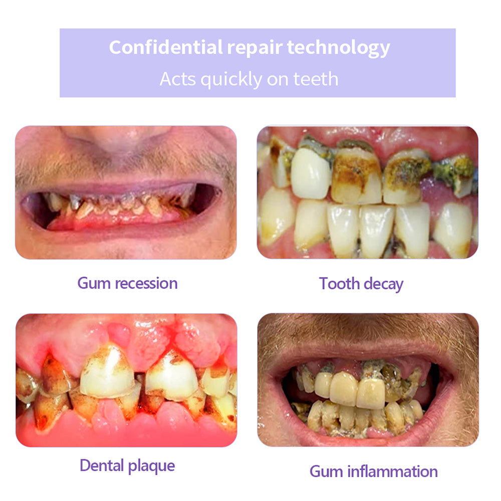 ODALIT™ TeethRestoration Mineral Powder🦷Obtain American Dental Association (ADA) Certification (Treats periodontitis and mouth ulcers, prevents tooth loss, and repairs gum recession)