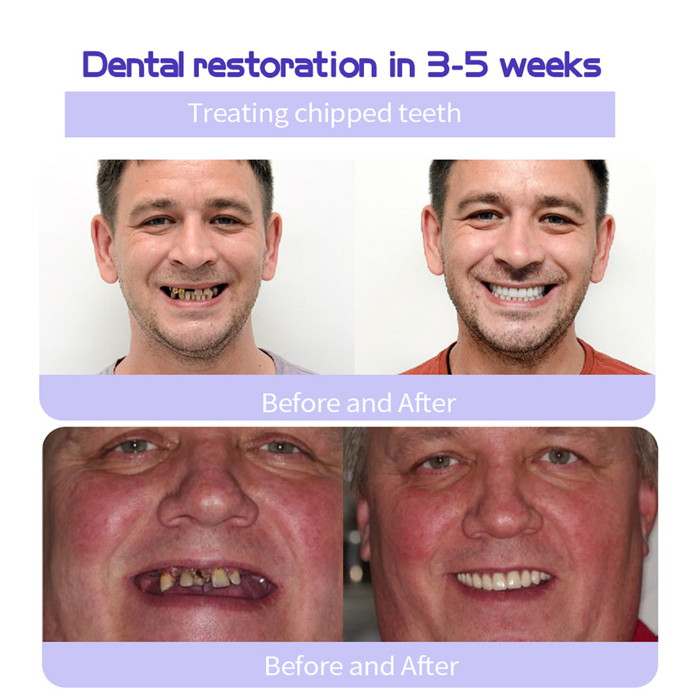 ODALIT™ TeethRestoration Mineral Powder🦷Obtain American Dental Association (ADA) Certification (Treats periodontitis and mouth ulcers, prevents tooth loss, and repairs gum recession)