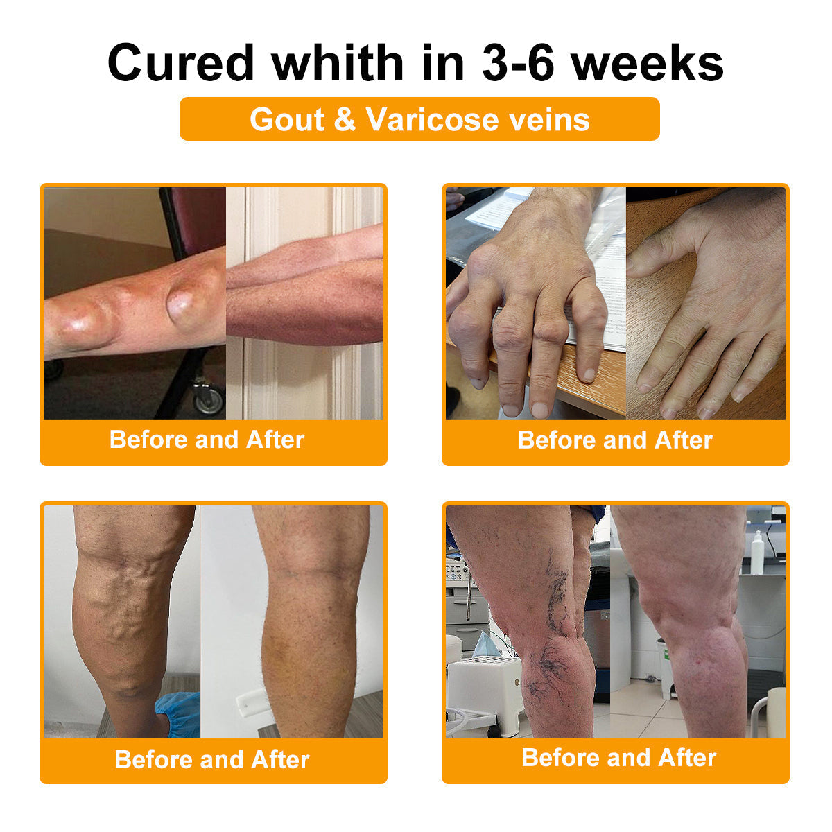 Nerve, Joint, or Arthritis Pain? This 15-Minute Cream Delivers Fast Relief & Deep Healing—No Pills, No Side Effects