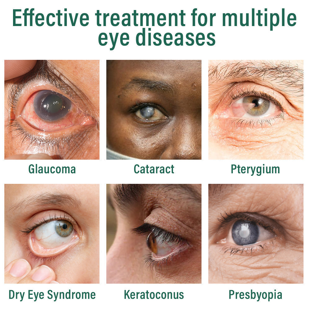 š©āāļøODALIT⢠Nano Eye Drops Serum ā
FDA Approved(Suitable for presbyopia, dry eye syndrome, glaucoma, and cataracts) āļøāļø
