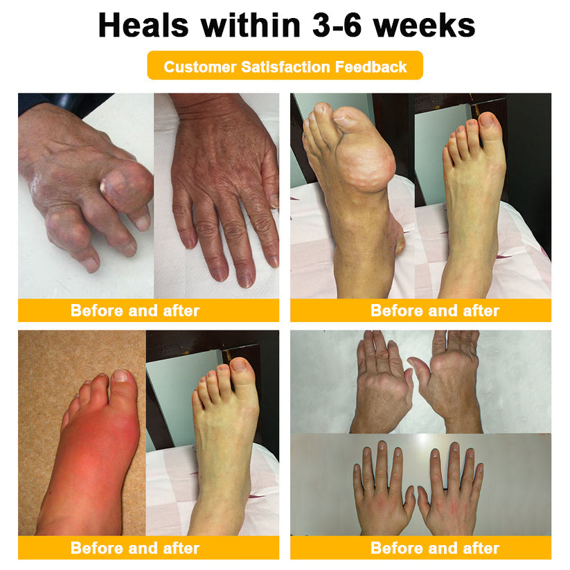 Nerve, Joint, or Arthritis Pain? This 15-Minute Cream Delivers Fast Relief & Deep Healing—No Pills, No Side Effects
