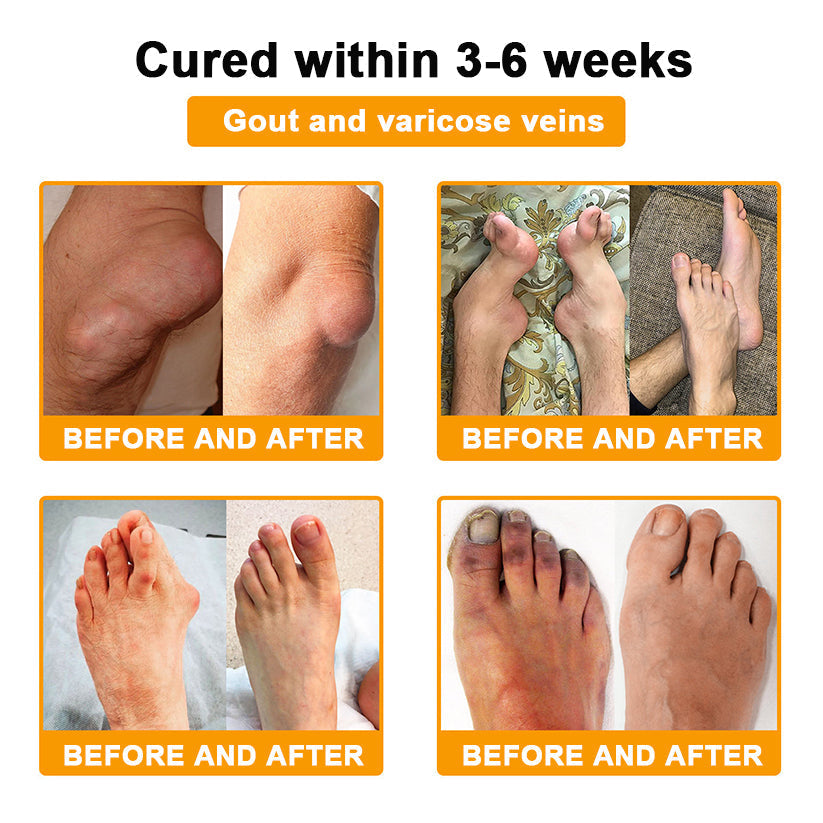 Nerve, Joint, or Arthritis Pain? This 15-Minute Cream Delivers Fast Relief & Deep Healing—No Pills, No Side Effects