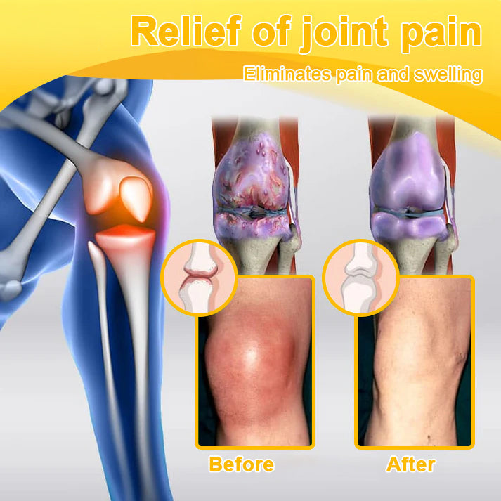Nerve, Joint, or Arthritis Pain? This 15-Minute Cream Delivers Fast Relief & Deep Healing—No Pills, No Side Effects