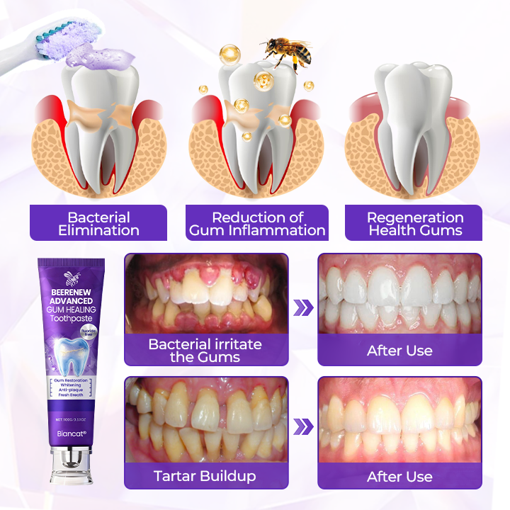 BeeRenew Advanced Gum Healing Toothpaste