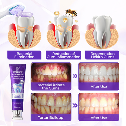 BeeRenew Advanced Gum Healing Toothpaste