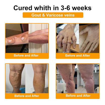 Nerve, Joint, or Arthritis Pain? This 15-Minute Cream Delivers Fast Relief & Deep Healing—No Pills, No Side Effects