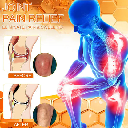 💧🐝NEGUSY™ Magnesium Oil & Bee Venom Joint Healing Spray👨‍⚕️Approved by the American Academy of Orthopaedic Surgeons (AAOS)