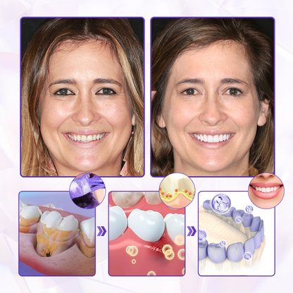 BeeRenew Advanced Gum Healing Toothpaste